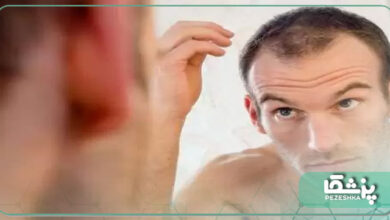 ریزش مو در مردان : درمان و راه حل ها