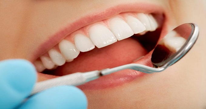 راه های حفظ سلامت دندان ها