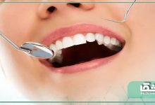 راهکارهایی برای حفظ و سلامتی دندان ها