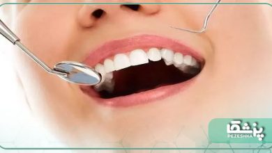 راهکارهایی برای حفظ و سلامتی دندان ها