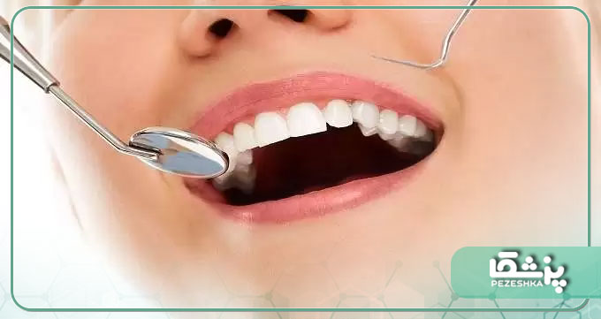 راهکارهایی برای حفظ و سلامتی دندان ها