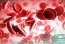 راهکار های پیشگیری و درمان کم خونی
