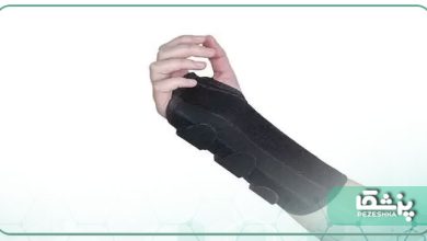 انواع بهترین مچ بند طبی