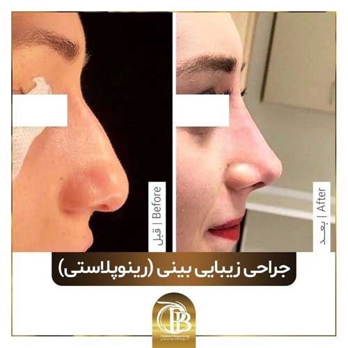 محبوب ترین جراحی زیبایی در ایران