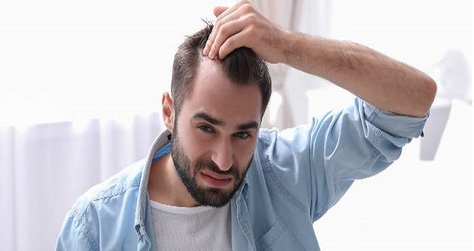 کاشت مو به روش ترکیبی چیست؟