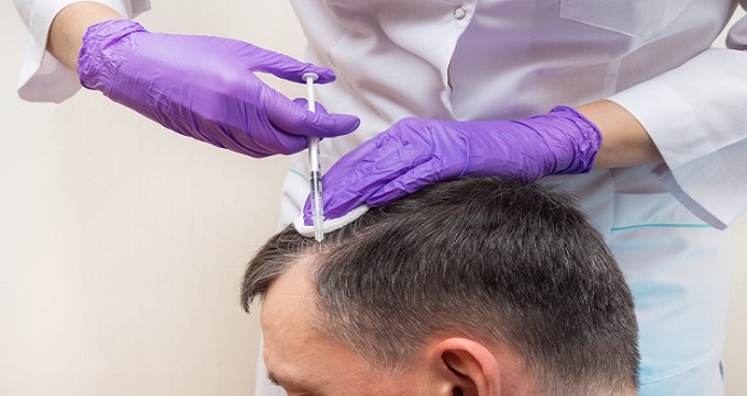 چه روش های برای درمان ریزش مو وجود دارد؟