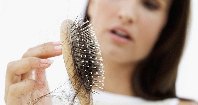 چه بانوانی ریزش مو را تجربه می کنند ؟