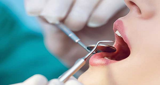 جراحی دندان در مشهد