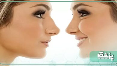 بهترین جراح بینی گوشتی در مازندران