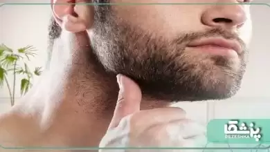بهترین دکتر کاشت ریش در شیراز