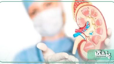 بهترین دکتر کلیه در سعادت آباد