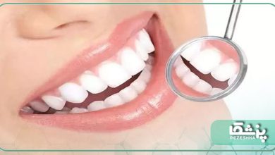 بهترین دندانپزشک زیبایی در سعادت آباد