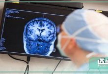 بهترین جراح تومور مغزی در ایران