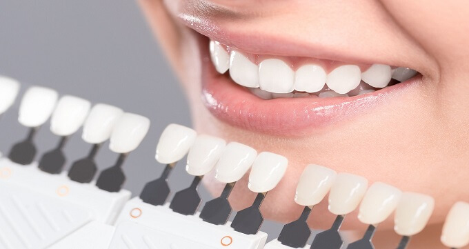  عوارض کامپوزیت دندان