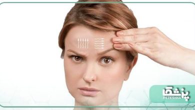 بهترین دکتر لیفت ابرو در مشهد