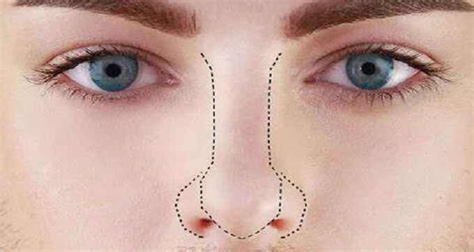 مراقبت های قبل از جراحی بینی