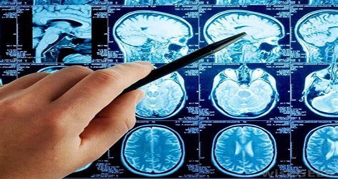 روش های درمانی جراح مغز و اعصاب