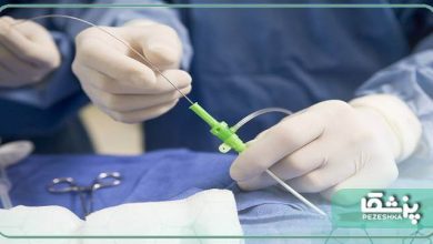 بهترین دکتر آنژیوگرافی در اصفهان