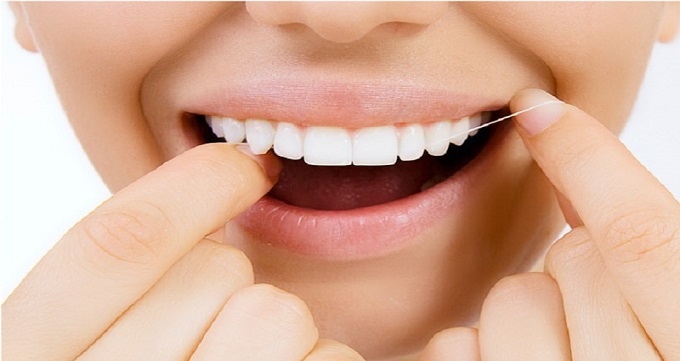 عوامل تاثیرگذار در هزینه های لمینت دندان