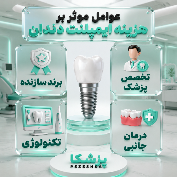هزینه ایمپلنت دندان در تهران