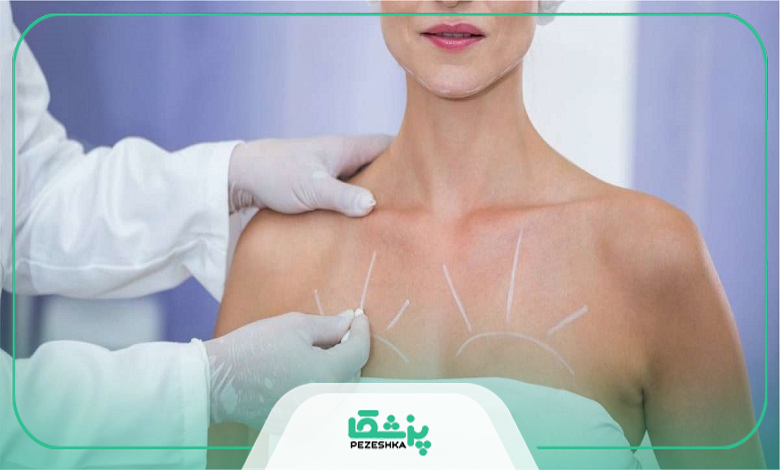 هزینه جراحی بهترین متخصص لیفت سینه در کرج چقدر است؟