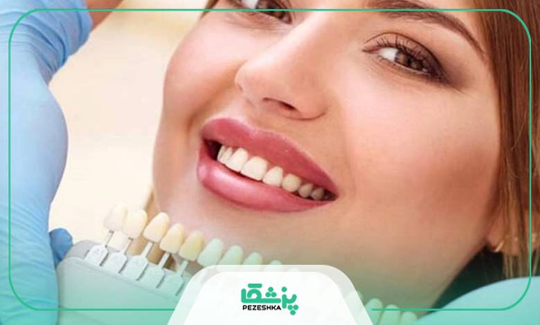 هزینه هر واحد کامپوزیت دندان