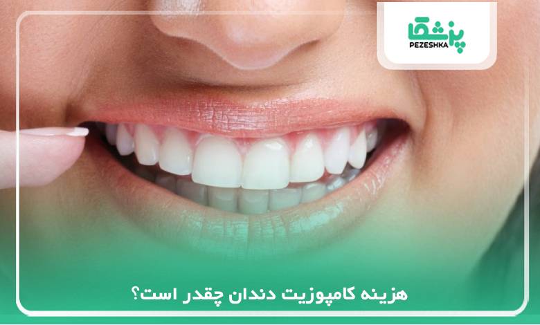 هزینه کامپوزیت دندان چقدر است؟