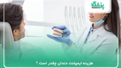 هزینه ایمپلنت دندان چقدر است ؟