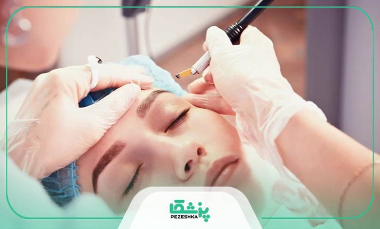 یا کاشت ابرو تحت پوشش بیمه سلامت است؟