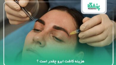 هزینه کاشت ابرو چقدر است ؟