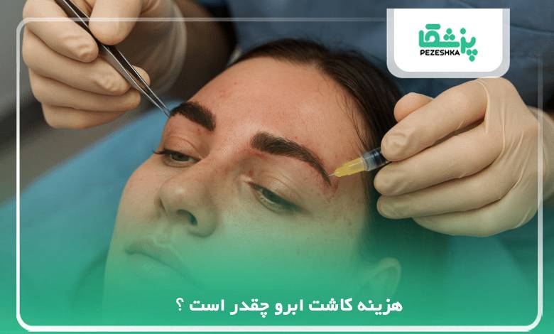 هزینه کاشت ابرو چقدر است ؟