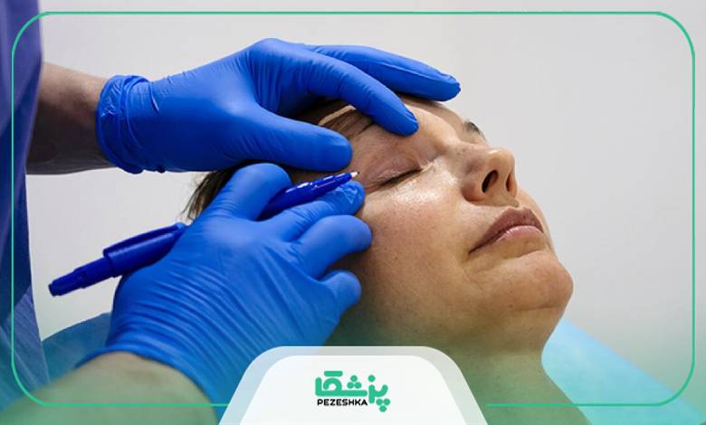 آیا بیمه جراحی چشم گربه را پوشش می دهد؟
