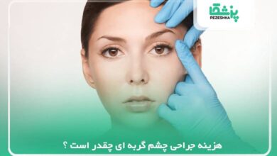 هزینه جراحی چشم گربه ای چقدر است ؟