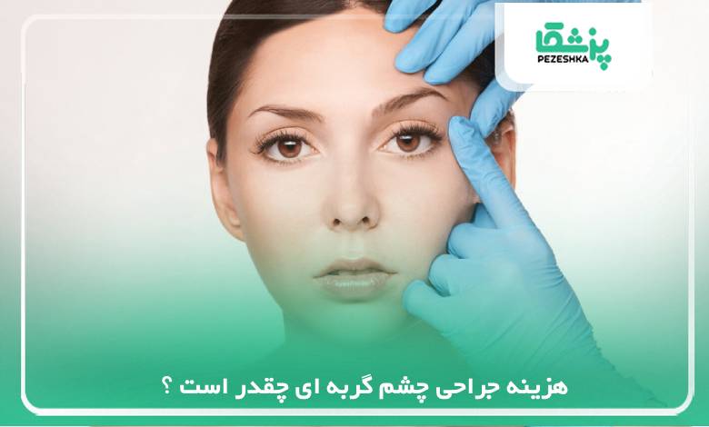 هزینه جراحی چشم گربه ای چقدر است ؟