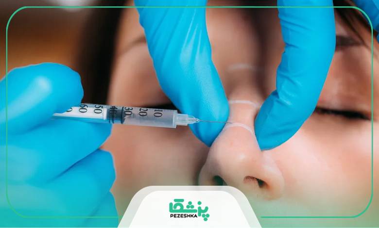 هزینه تزریق فیلر بینی در سال 1403