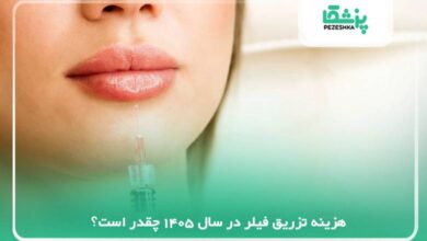 هزینه تزریق فیلر در سال 1405 چقدر است؟