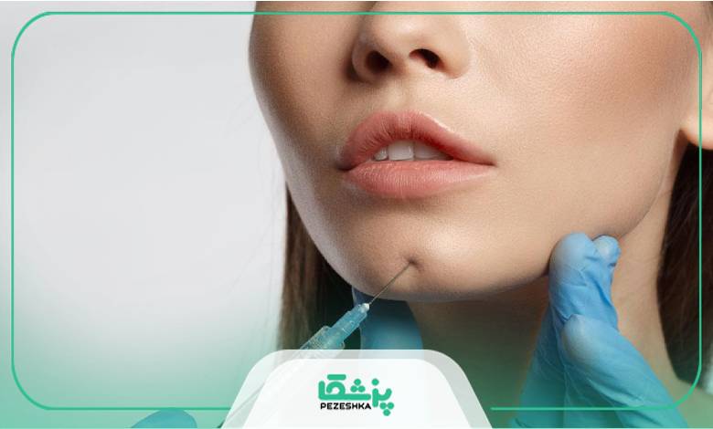 هزینه تزریق ژل به چانه