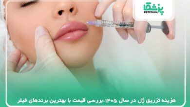 هزینه تزریق ژل در سال 1405،بررسی قیمت با بهترین برندهای فیلر