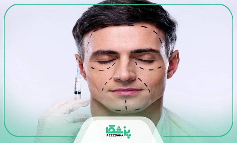 معایب زاویه سازی
