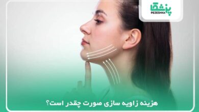 https://pezeshka.net/how-much-does-it-cost-to-angle-the-face-1401-f/