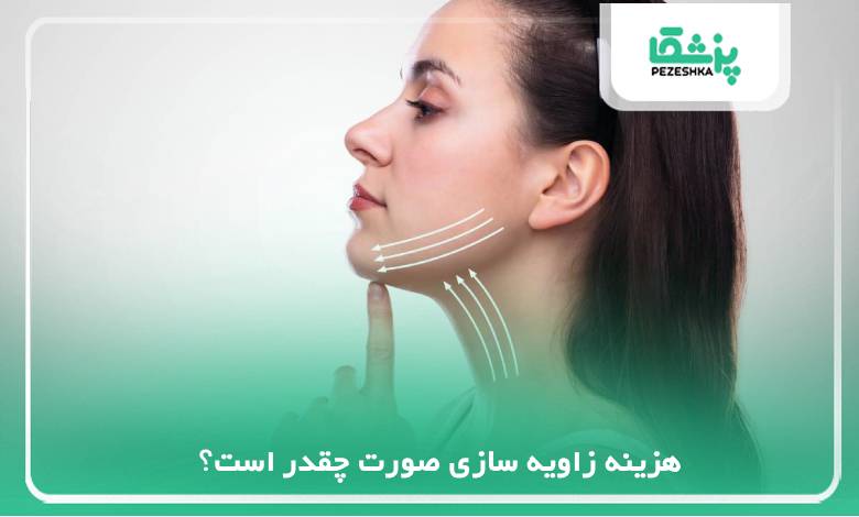 https://pezeshka.net/how-much-does-it-cost-to-angle-the-face-1401-f/