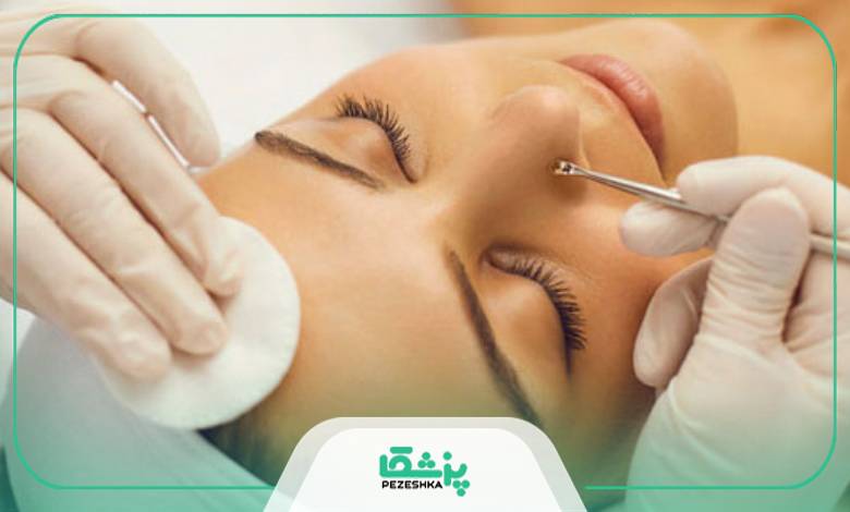 عوامل موثر بر قیمت پاکسازی پوست صورت