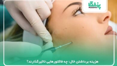 هزینه برداشتن خال؛ چه فاکتورهایی تاثیرگذارند؟