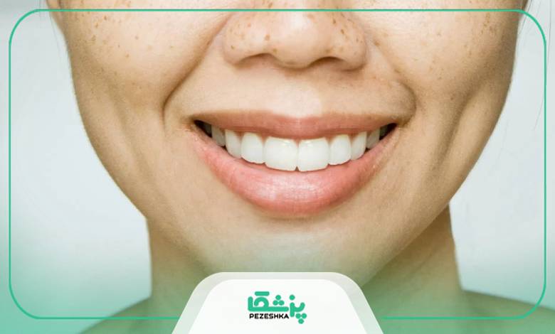 هزینه عمل زیبایی چال گونه به چه صورت حساب می شود؟