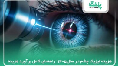 هزینه لیزیک چشم در سال1405؛ راهنمای کامل برآورد هزینه