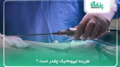هزینه لیپوماتیک چقدر است ؟