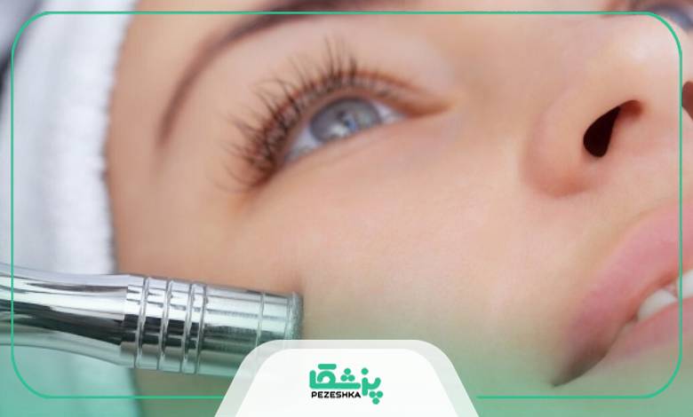 مزایای میکرودرم چیست؟
