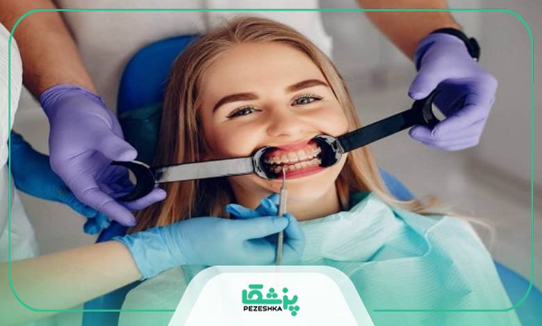 مراقبت از ابزار های ارتودنسی