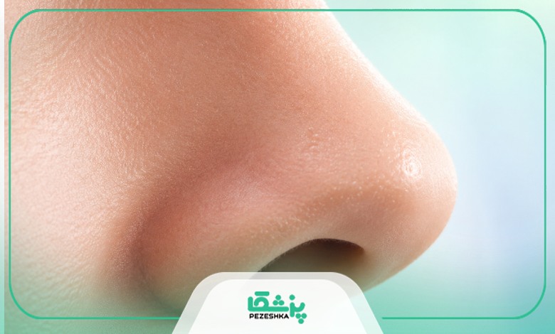 هزینه های عمل بینی شامل چه چیزهایی می شود؟