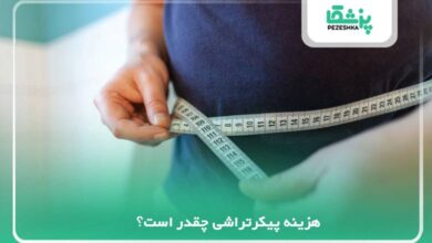 هزینه پیکرتراشی چقدر است؟